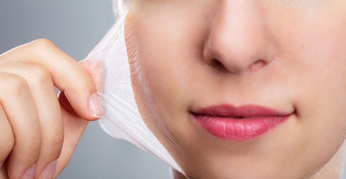 What You Should & Shouldn't Do After A Chemical Peel