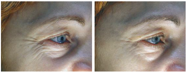 Advanced Retinol Eye Cream