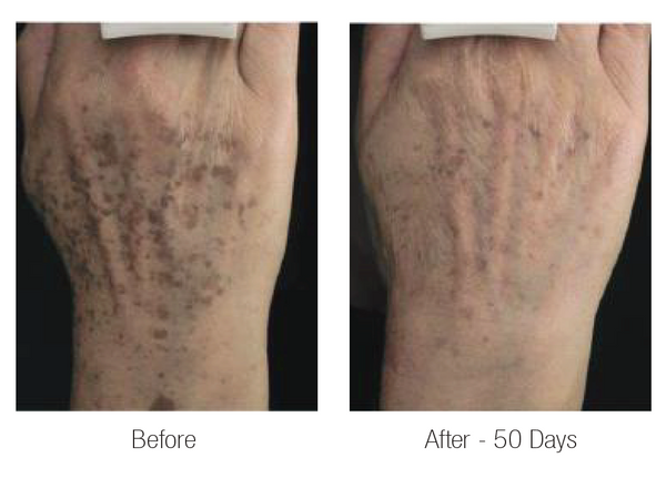 Natural Pigment Corrector