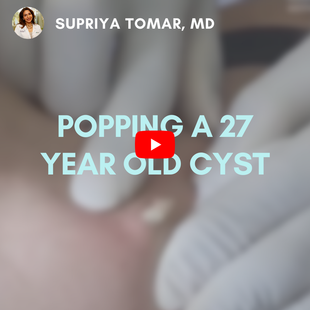 Pimple Popping Video Gallery | SupriyaMD Skincare Acne Extractions